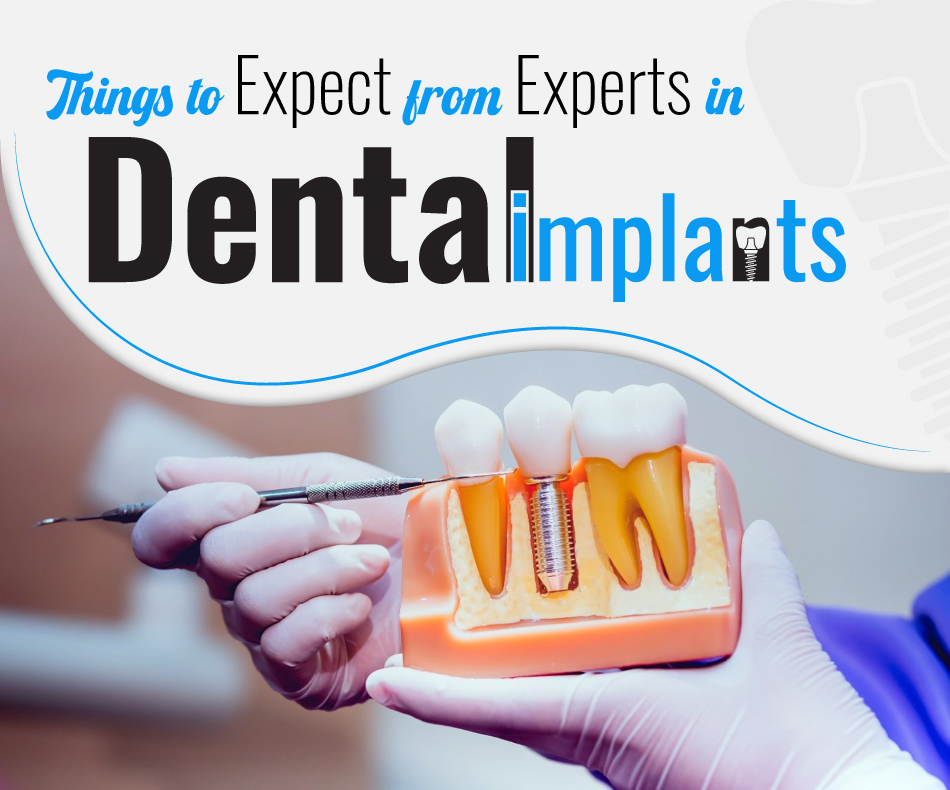 Things-to-Expect-From-Experts-in-Dental-Implants